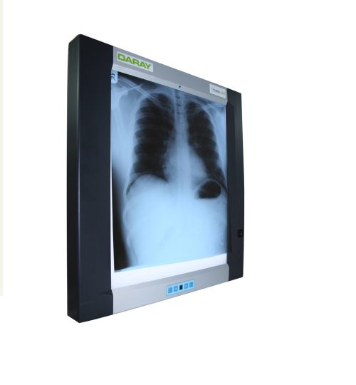 X-Ray View Machine(Premium, Swetika, Good Quality)